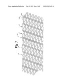 Helical Stent Design diagram and image