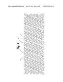 Helical Stent Design diagram and image