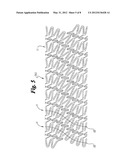 Helical Stent Design diagram and image