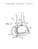 ADJUSTABLE ANNULOPLASTY DEVICES AND ADJUSTMENT MECHANISMS THEREFOR diagram and image