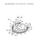 ADJUSTABLE ANNULOPLASTY DEVICES AND ADJUSTMENT MECHANISMS THEREFOR diagram and image