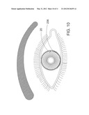 Ocular Implant Architectures diagram and image