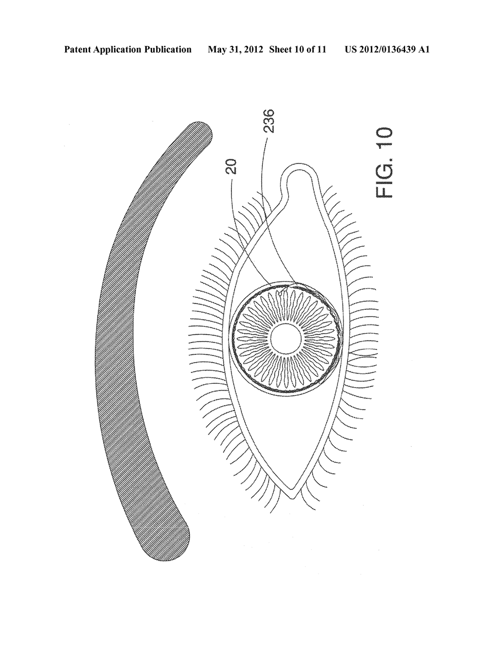 Ocular Implant Architectures - diagram, schematic, and image 11