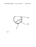 IMPLANT SYSTEM HAVING AT LEAST THREE SUPPORT ELEMENTS diagram and image