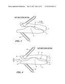 POSTERIOR SPINAL ARTHROPLASTY SYSTEM diagram and image