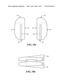 POSTERIOR SPINAL ARTHROPLASTY SYSTEM diagram and image