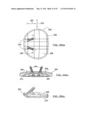 POSTERIOR SPINAL ARTHROPLASTY SYSTEM diagram and image