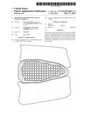 PROSTHESES FOR SPINE DISCS HAVING FUSION CAPABILITY diagram and image