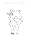 BONE PROTECTOR, KIT AND METHOD diagram and image