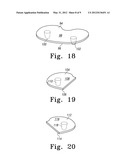 BONE PROTECTOR, KIT AND METHOD diagram and image