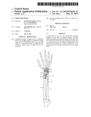 WRIST PROSTHESIS diagram and image