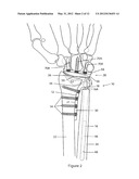 WRIST PROSTHESIS diagram and image