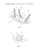 WRIST PROSTHESIS diagram and image