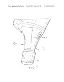 PROSTHETIC HIP IMPLANTS diagram and image