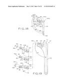 PROSTHETIC HIP IMPLANTS diagram and image