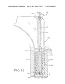 PROSTHETIC HIP IMPLANTS diagram and image