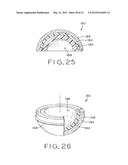 PROSTHETIC HIP IMPLANTS diagram and image