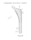 PROSTHETIC HIP IMPLANTS diagram and image