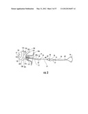 PYLORIC VALVE DEVICES AND METHODS diagram and image