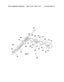 PYLORIC VALVE DEVICES AND METHODS diagram and image