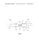 PYLORIC VALVE DEVICES AND METHODS diagram and image