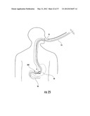 PYLORIC VALVE DEVICES AND METHODS diagram and image