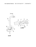 PYLORIC VALVE DEVICES AND METHODS diagram and image