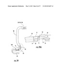 PYLORIC VALVE DEVICES AND METHODS diagram and image