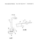 PYLORIC VALVE DEVICES AND METHODS diagram and image