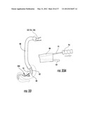 PYLORIC VALVE DEVICES AND METHODS diagram and image