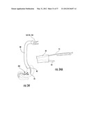 PYLORIC VALVE DEVICES AND METHODS diagram and image