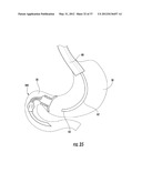 PYLORIC VALVE DEVICES AND METHODS diagram and image