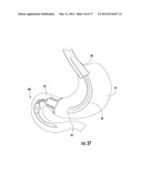 PYLORIC VALVE DEVICES AND METHODS diagram and image