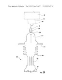 PYLORIC VALVE DEVICES AND METHODS diagram and image