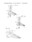 ELECTRONICALLY CONTROLLED PROSTHETIC SYSTEM diagram and image