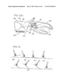 ELECTRONICALLY CONTROLLED PROSTHETIC SYSTEM diagram and image