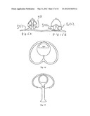 ELECTRONICALLY CONTROLLED PROSTHETIC SYSTEM diagram and image