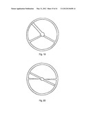 ELECTRONICALLY CONTROLLED PROSTHETIC SYSTEM diagram and image