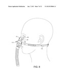 PATIENT INTERFACE SYSTEMS diagram and image