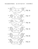 PATIENT INTERFACE SYSTEMS diagram and image