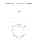 ANODIZING APPARATUS diagram and image