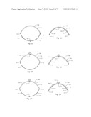 INSTANT SNAP CLOSURE MECHANISM diagram and image