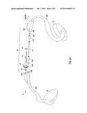 PERSONAL AUDIO SET WITH ADJUSTABLE FORCE MECHANISMS diagram and image