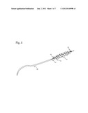 Deformable Motion Correction for Stent Visibility Enhancement diagram and image