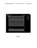 Ultrasound Image Performance Determination diagram and image