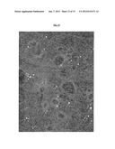 Methods of Inhibiting Metastasis from Cancer diagram and image