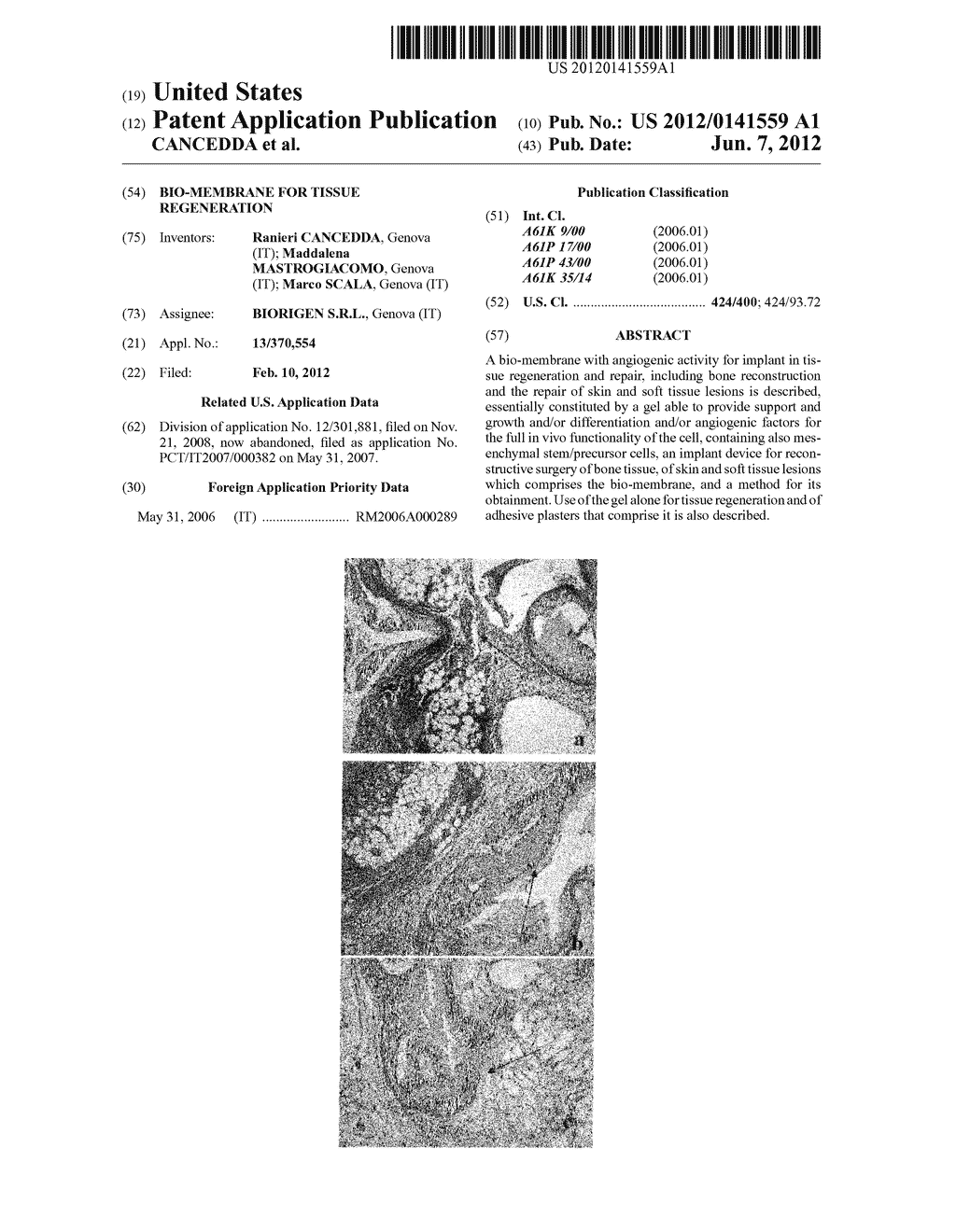 BIO-MEMBRANE FOR TISSUE REGENERATION - diagram, schematic, and image 01