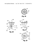 IRRIGATING DEVICE WITH REED VALVE diagram and image