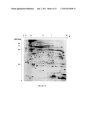 Biomarkers for Follicular Thyroid Carcinoma and Methods of Use diagram and image