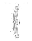 Sport Ball With Indented Casing diagram and image